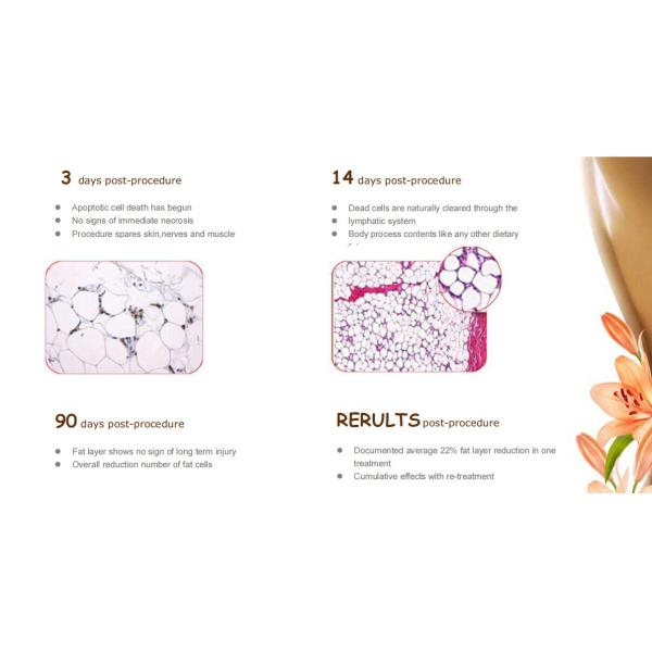 Тело машин удаления уменьшения целлюлита жирное уменьшая оборудование красоты