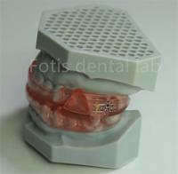 Affordable Dental Lab Hyrax Expander Orthodontic Retainer Easy To Clean And Maintain