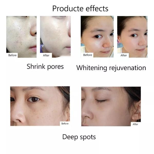 Профессиональная ручка Microneedling - беспроводная ручка Derma автоматическая - самый лучший инструментальный ящик заботы кожи для стороны и тела