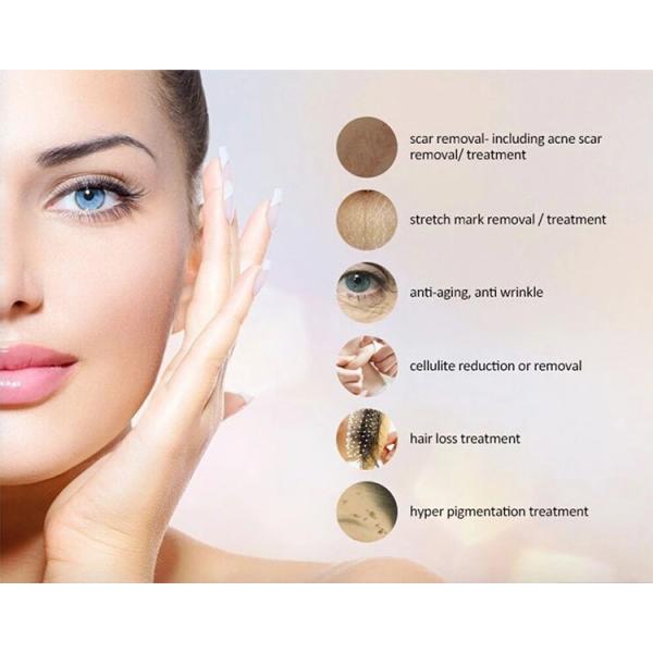 Effective NO Plugs Type Microneedle Derma Roller Zgts with Titanium Alloy Needles