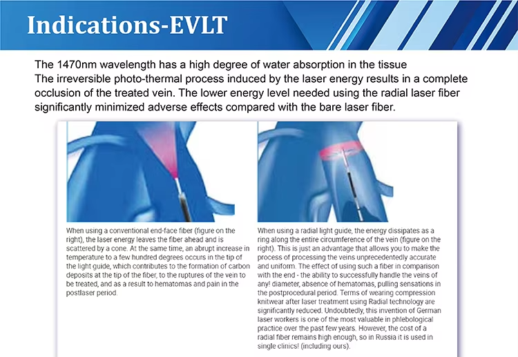Leg Varicose Veins Laser Treatment EVLT  1940NM Diode Laser Machine