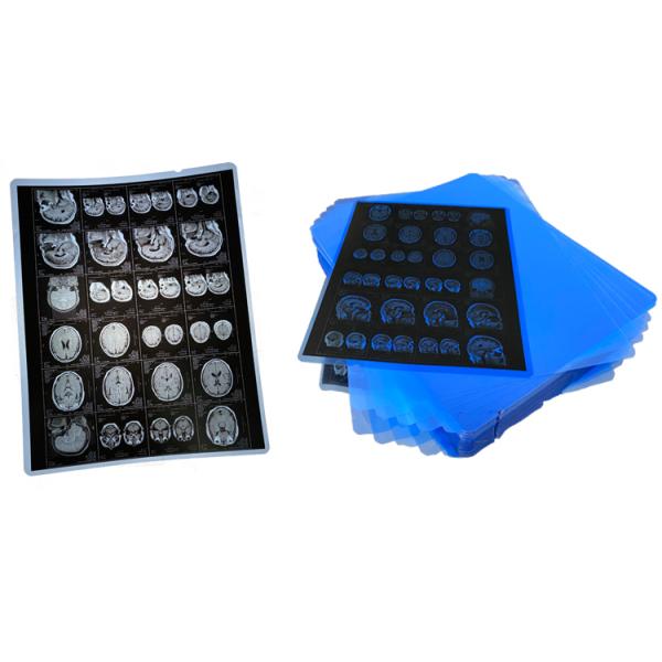 El ANIMAL DOMÉSTICO impermeable de 215 micrones basó X médico Ray Film