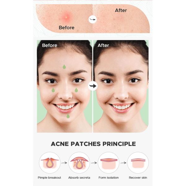 Cute Fun Shaped Acne Patches Matte Invisible Pimple Cover Patch For Face Skin Care