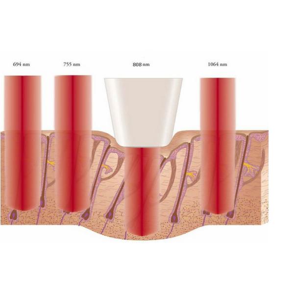 Salon Beauty Equipment Diode Laser Hair Removal Machine , Underarm Hair Removal Machine