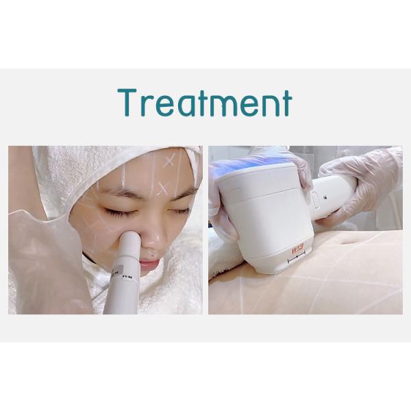 Appareil de beauté à ultrasons 220V-240V / machine de lifting facial Système de contourage du corps pour le commerce