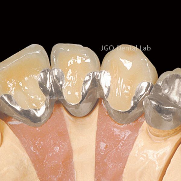 Porcelain Fused to Metal Crown and Bridge Made in China Dental Lab
