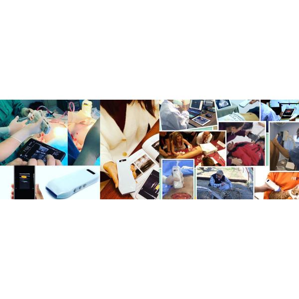 128 Elements Medical Hospital Equipments Color Doppler Portable Wireless Ultrasound Machine 3 In 1