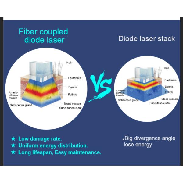 Светлые длины волны машины 3 удаления волос тела лазера волокна ручки