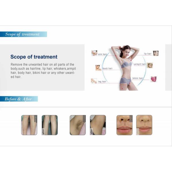 Portable diode laser hair removal machine