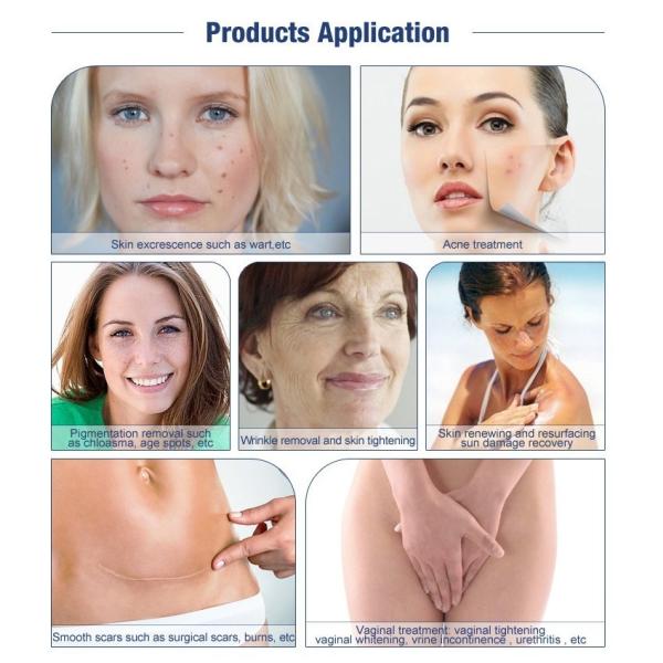 Germany Fractional CO2 Laser Skin Resurfacing Lattice Laser Skin Beauty Machine