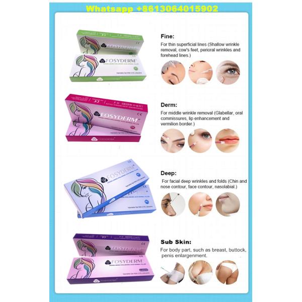 заполнитель 2ml Fosyderm для губ щек Chin извлекая кислоту морщинок Hyaluronic