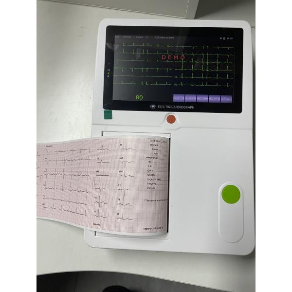 Новый продукт Электрокардиограмма 12-канальная ЭКГ Электрокардиограмма ЭКГ