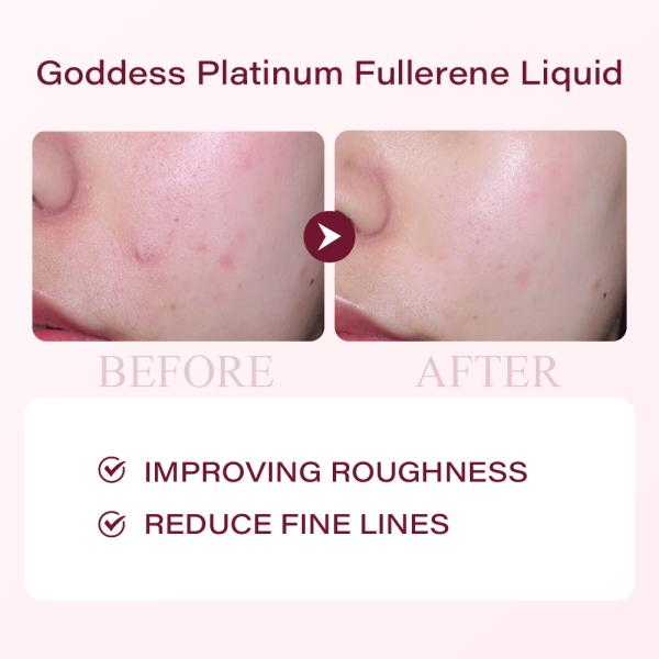 Professional Customized Platinum Fullerene Rose Facial Serum Beauty Salon Spa Skin Revitalizer for Firming Whitening Face