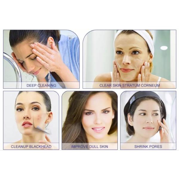 Диамант Dermabrasion 4 подсказок слезает гидро лицевые машины