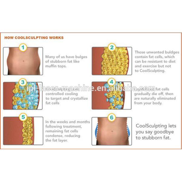 High Quality Body Shape Ultrasound Whole Body Slimming Fat Reduction Cryolipolysis Machine