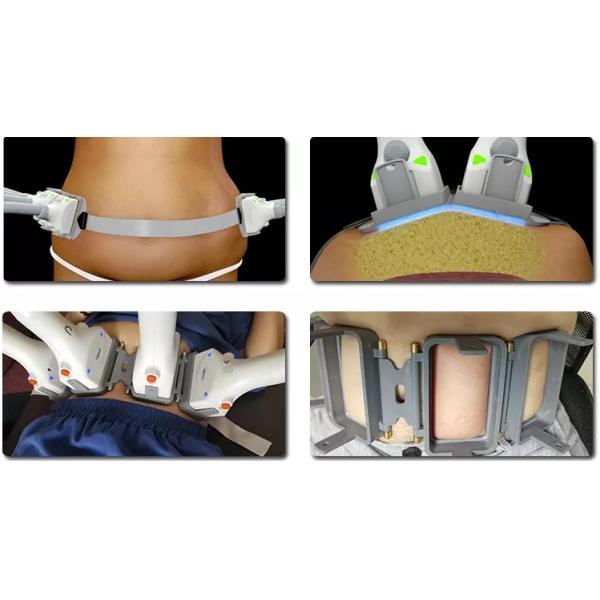 Non-Invasive Body Slimming With 1060nm Diode Laser Lipolysis Fat Removal Machine Sculpsure Warm Sculpting