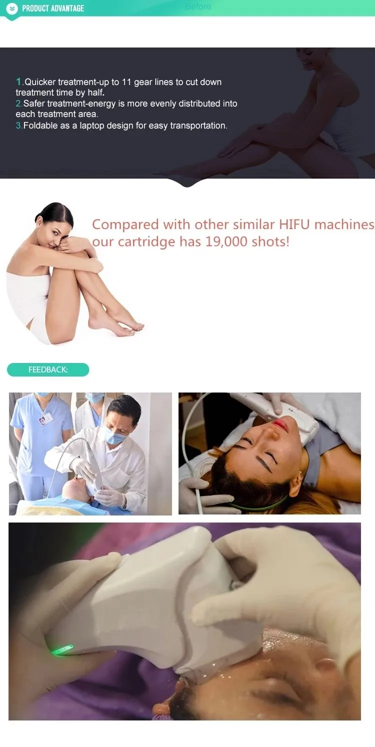 New design Mini 3D Hifu machine for face lifting and body shaping