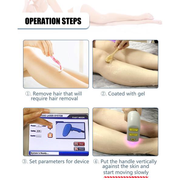 CE Approved 808 Diode Laser Hair Removal Machine 600W Painless Epilator