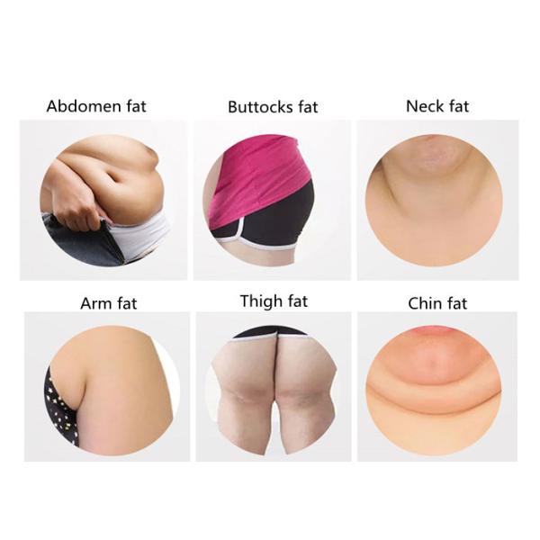 Slimming Touch Screen Portable Cryolipolysis Machine Ce Certification