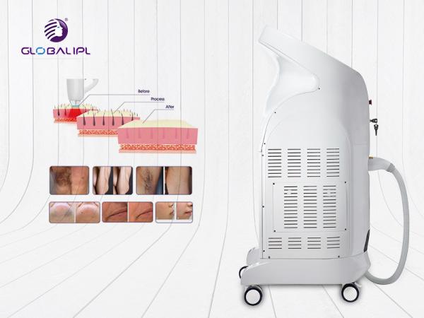 High Power 1000W Diode Laser Hair Removal Machine With 10.4 Color Touch LCD Screen