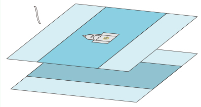 Ophthalmic Soft Non Woven Sterile Surgical Packs Water Impermeable