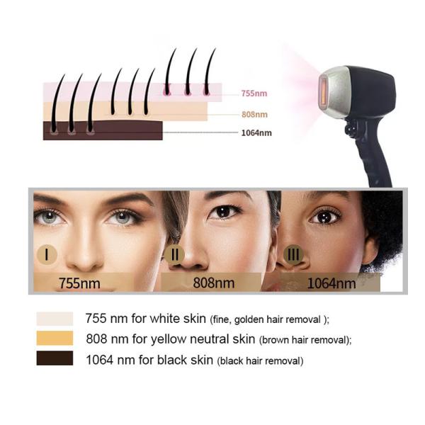 Ice Titanium Pain Free Diode Laser Hair Removal Machine Price