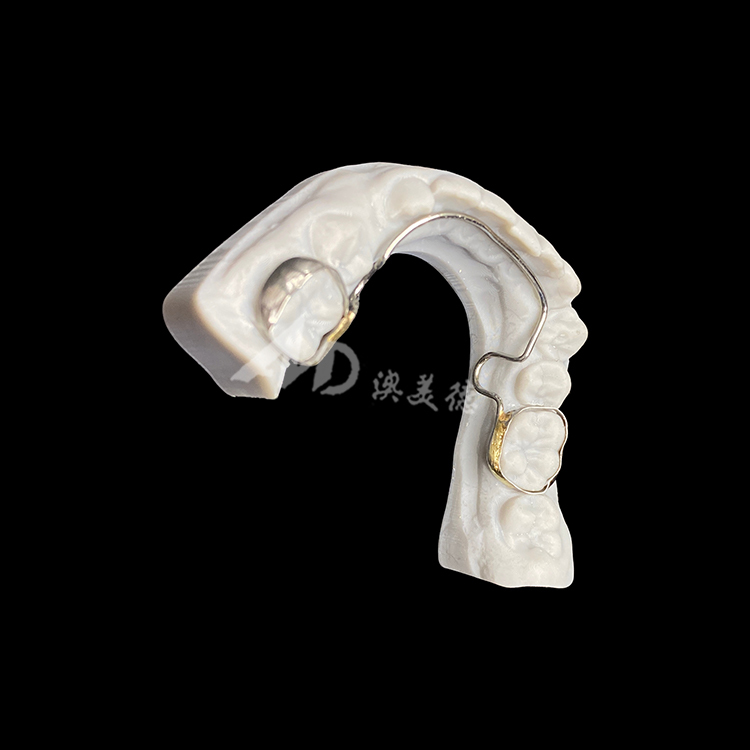 Custom Lingual Arch with Bands Orthodontic Appliance for Space Maintenance and Dental Alignment
