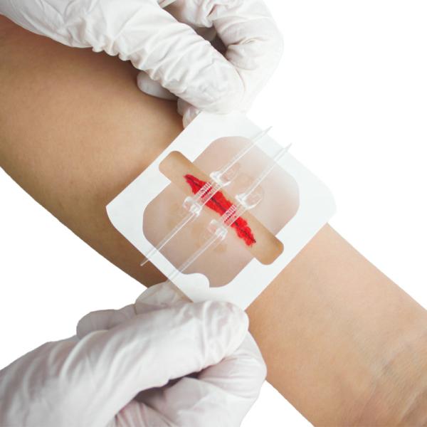 Dispositif de fermeture de plaie de bandages en tissu flexible 2 / 4 / 6PCS