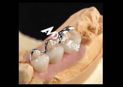Strong PFM Porcelain Fused To Metal Crown Excellent Biocompatibility Wear Resistance