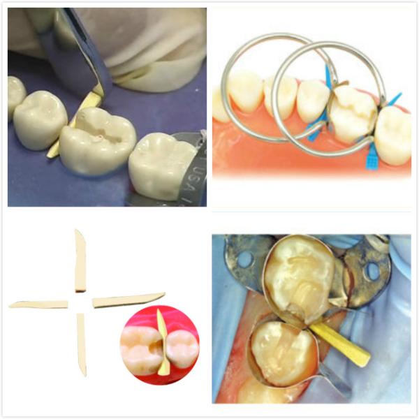 Fixing Wooden Wedges Dental Packaging Of 400 Pcs / Kit With 6 Colors