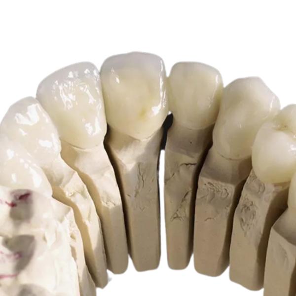 High Strength Zirconia Ceramic Crown High Hardness Good Adhesion