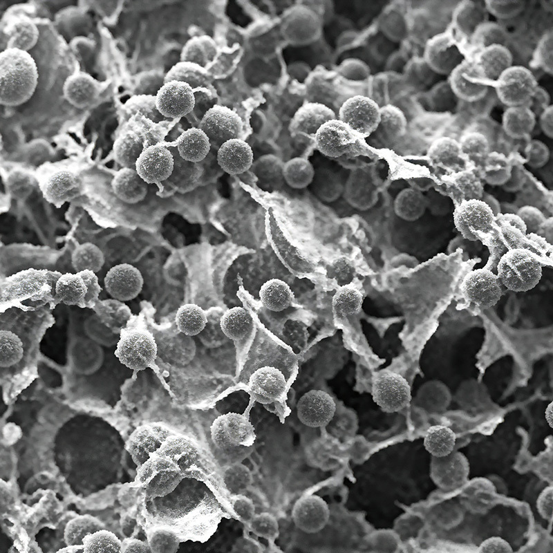 Biodegradable PLLA Polymer High Purity Injectable Dermal Filler For Medical Applications