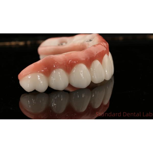 Высококачественная зубная цирконовая корона и All On Four Six Implant Full Arch / Китайская стоматологическая лаборатория