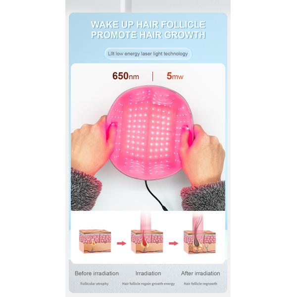 650nm Lllt Red Light 200 Diode Hair Loss Treatment Laser Helmet Hair Growth