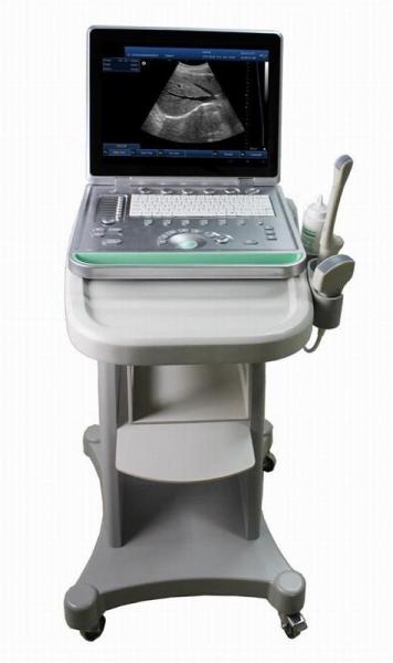Portable Ultrasound Device Portable Ultrasound Scanner Color Doppler with 2 USB Ports