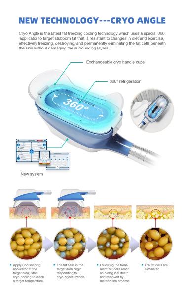 360 Degree Cryolipolysis Slimming Machine 4 Handle Fat Freeze