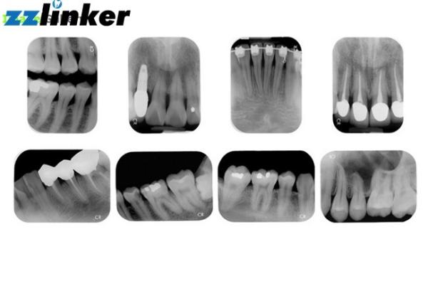 Varredor 240V USB 2,0 14 dentes X Ray Machine do bocado 17Lp/Mm