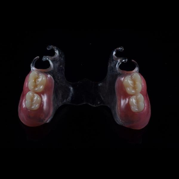 Custom Made Acrylic Removable Partial Denture Single Tooth