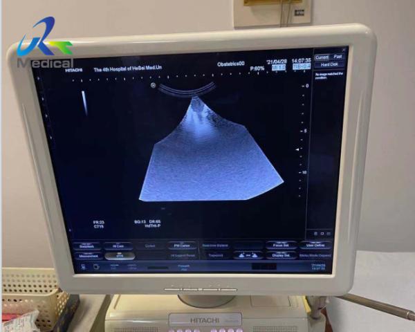 O reparo da máquina de Hitachi Aloka Ascendus Image Missing Ultrasound substitui a placa de TRX