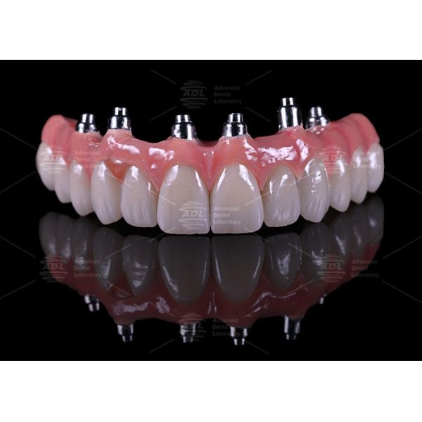 China Dental Lab Titanium Screw Retained Malong Design A1 Shade Full Arch Hybrid Bridge