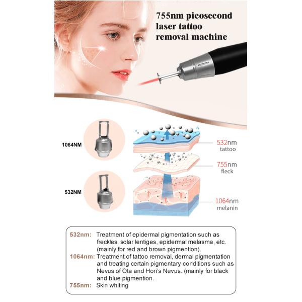 dispositif de laser de diode de chargement initial de 300W YAG pour l'épluchage de carbone de retrait de sourcil