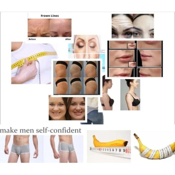 Dermal Filler Butt Lift Poly-L-Lactic Acid Injection