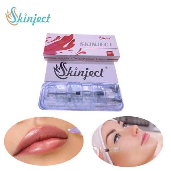 заполнитель 1ml Juvederm дермальный для стороны губы извлекая морщинки Skinject Allergan