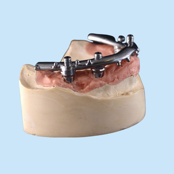 CNC титана All-On-4 имплантирует обеспеченные Dentures для зубоврачебной клиники