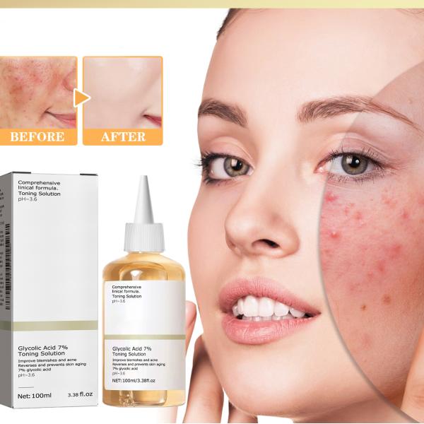 Solución tonificante de ácido glicólico de 7% para el tono facial para cuidado de la piel seca/grasa/sensible Exfoliante facial para adultos
