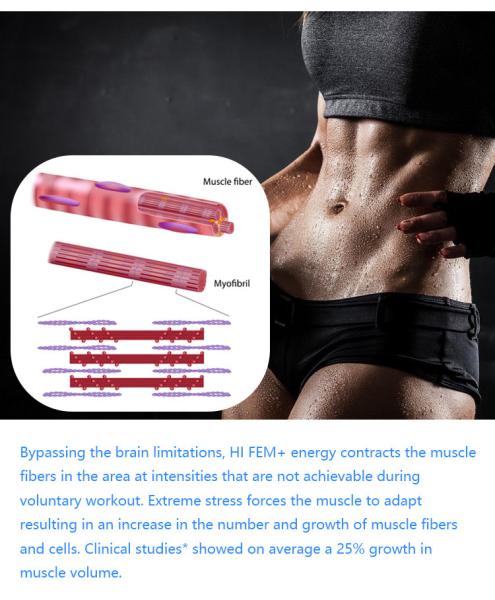 2 / 4/5 manijas RF Emslim Nova Machine EMShapeing Fat Burning