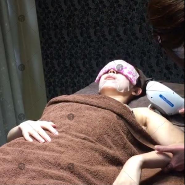 Ce Vascular Acne Removal Ipl Skin Rejuvenation Equipment 485nm