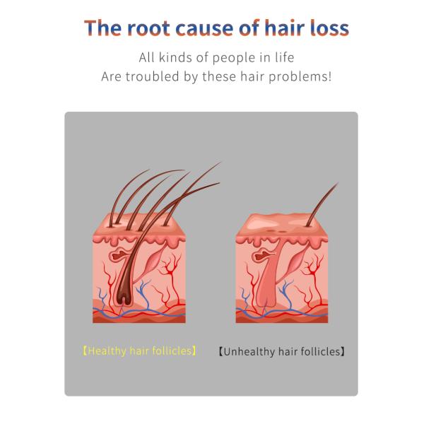 Красный голубой светлый электрический гребень Massager вибрации EMS гребня обработки выпадения волос терапией