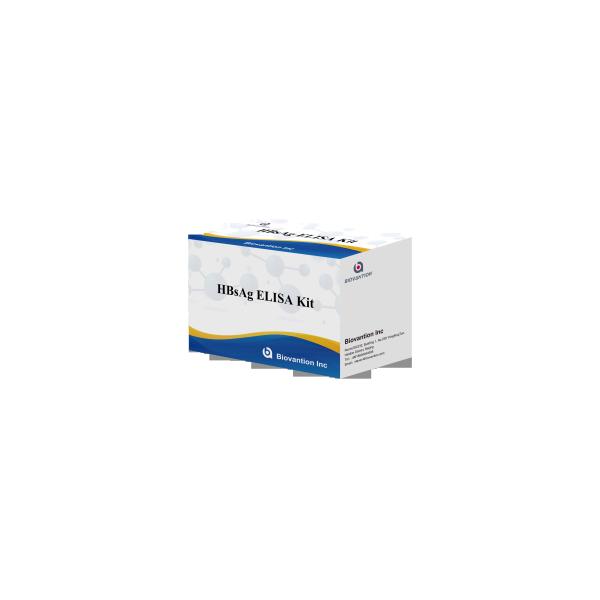 ELISA detection reagent kit High Accuracy HBsAg Elisa Test Kit