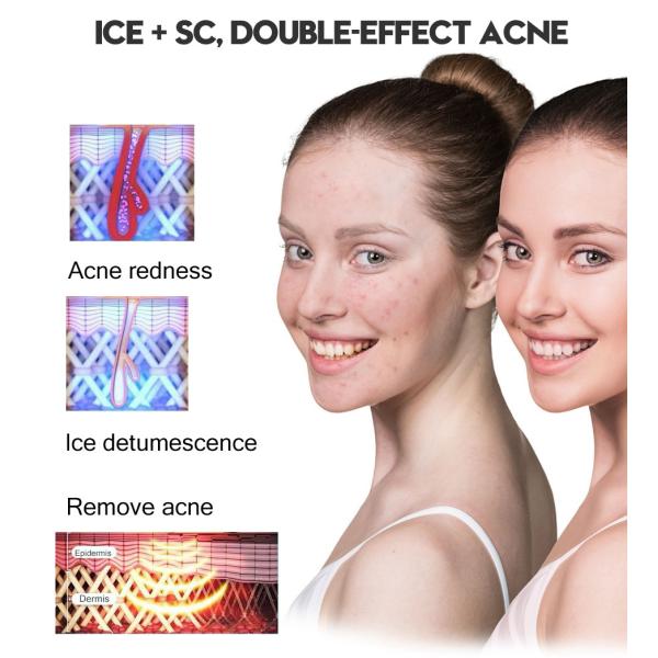 Bikini Trimmer Laser Hair Removal Home Device IPL Laser ICD Cool LCD Display Machine